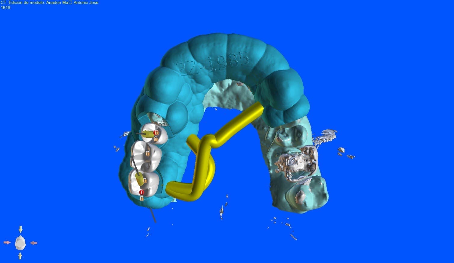 Straumann Dental Implant System